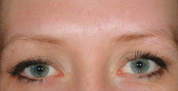 After Results for Cosmetic