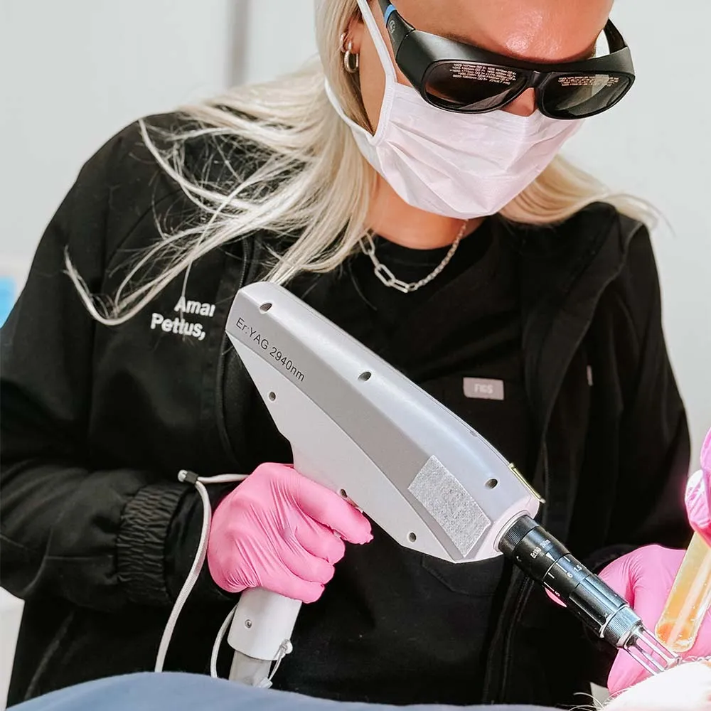 Erbium Skin Resurfacing in Santa Clarita