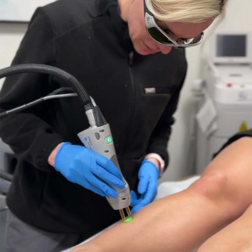 Laser Hair Removal in Santa Clarita