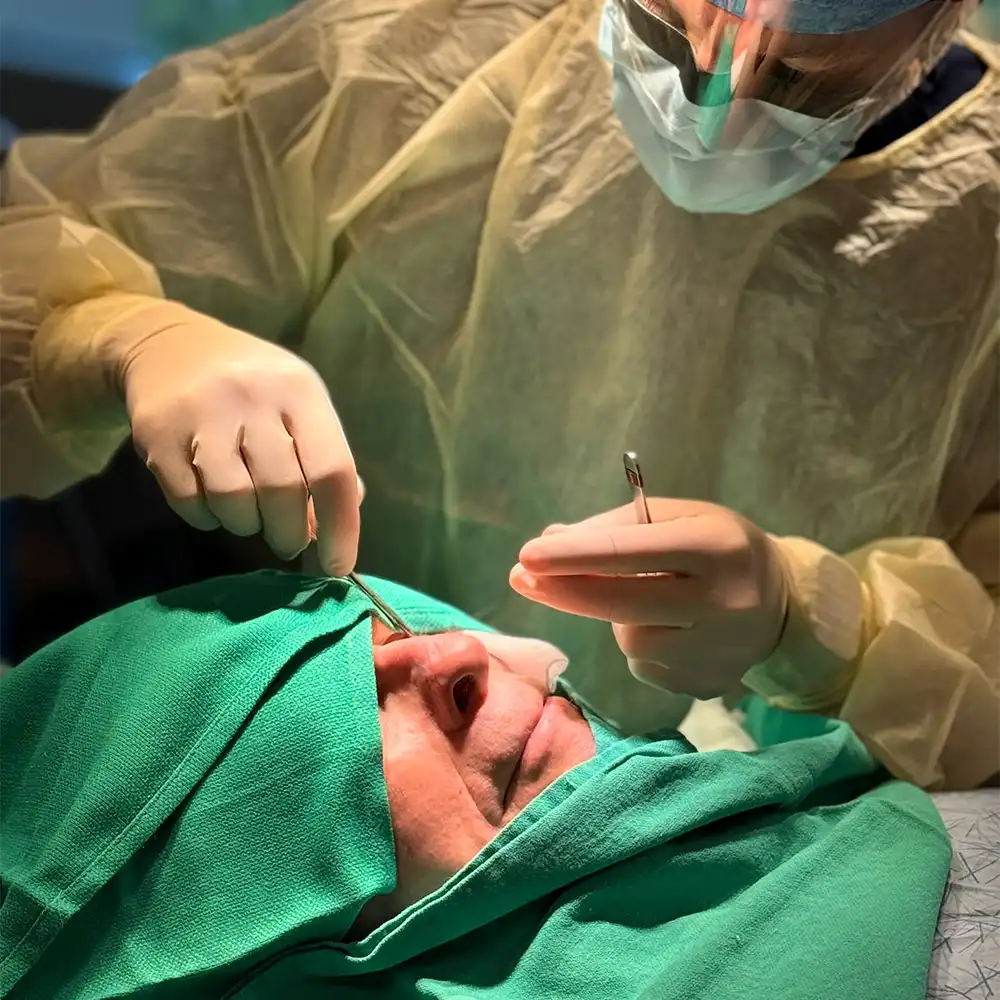 Scar Reduction in Santa Clarita
