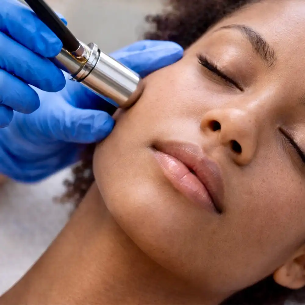 Microdermabrasion in Santa Clarita