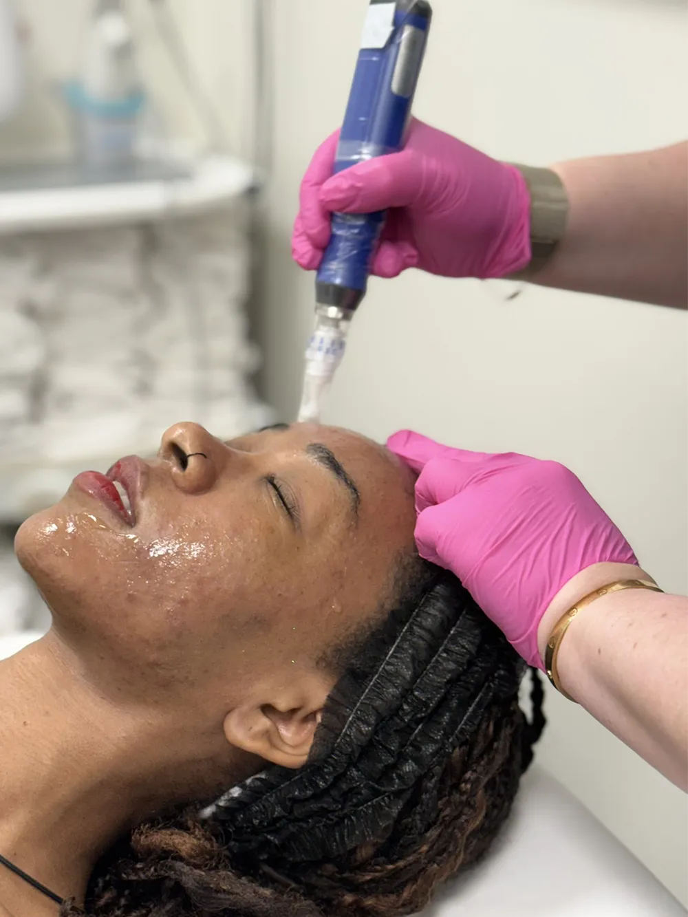 Excisional Surgery in Santa Clarita